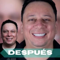 Carillas después