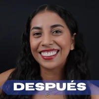 Gingivectomía después