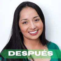 Diseño de sonrisa después
