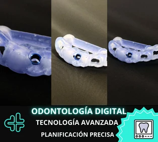 Odontología digital y planeación clínica