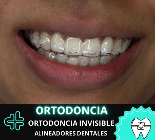 Ortodoncia en Bucaramanga