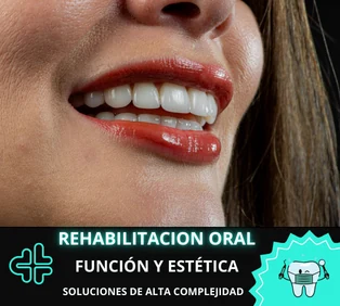 Rehabilitación oral integral